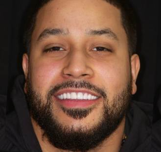 A man with a beard, smiling at the camera.