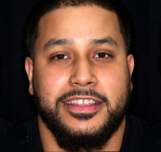 The image shows a man with a beard and mustache, smiling at the camera. He has short hair and is wearing what appears to be a dark top. The background is not distinctly visible but seems to be a plain, dark surface.