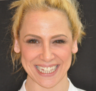The image is a photograph of a smiling woman with light brown hair, wearing makeup and a white top.