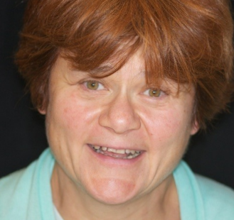 The image is a photograph of a person with short, red hair and fair skin. They are smiling and wearing a light-colored top. The background is plain and dark in color, providing a high contrast to the subject.