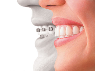 The image shows a side-by-side comparison of a person s face with their teeth and the same face without teeth, emphasizing the importance of dental health.