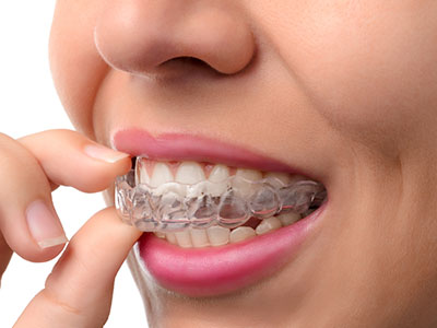 A person wearing clear braces, examining their teeth with a finger.