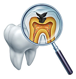 The image shows a magnified view of a human tooth with its root, gum line, and the surrounding area highlighted in blue. A magnifying glass is placed over the tooth, and there s an illustration of a dentist s hand holding the magnifying glass.