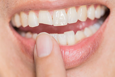 The image features a close-up of a person s smiling face with teeth, and their hand is holding a finger in front of their mouth.