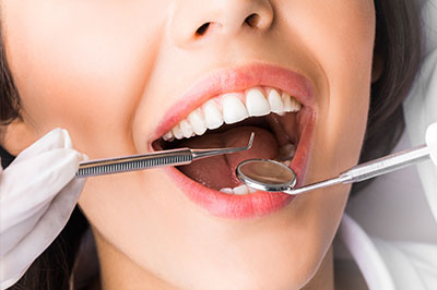 A close-up of a woman with her mouth open, receiving dental treatment from a dentist, with tools visible in the process.