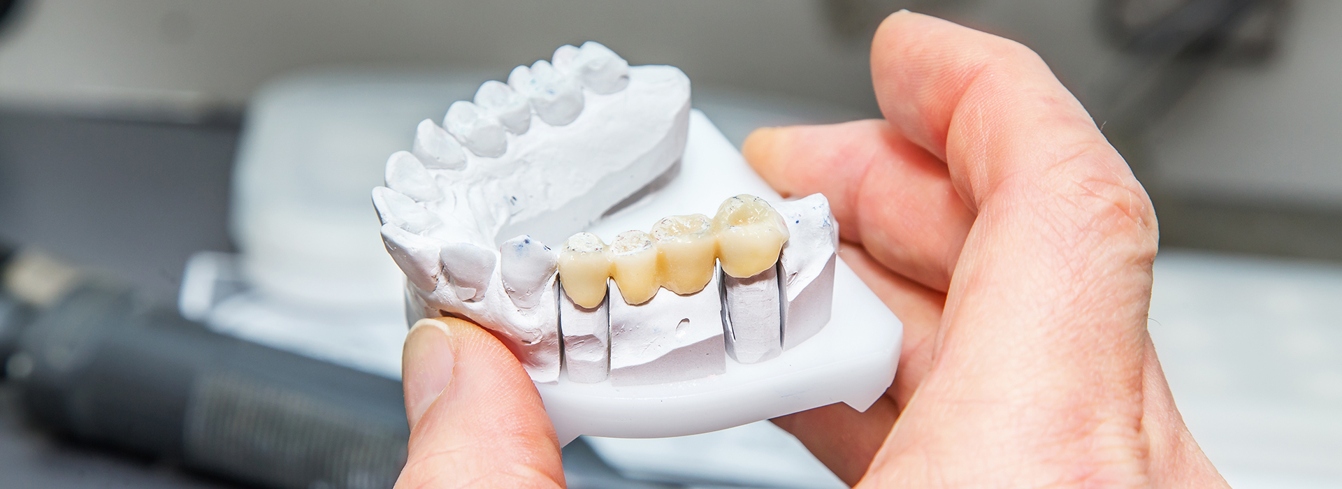 Person holding a 3D printed dental model, showcasing its intricate details and design.