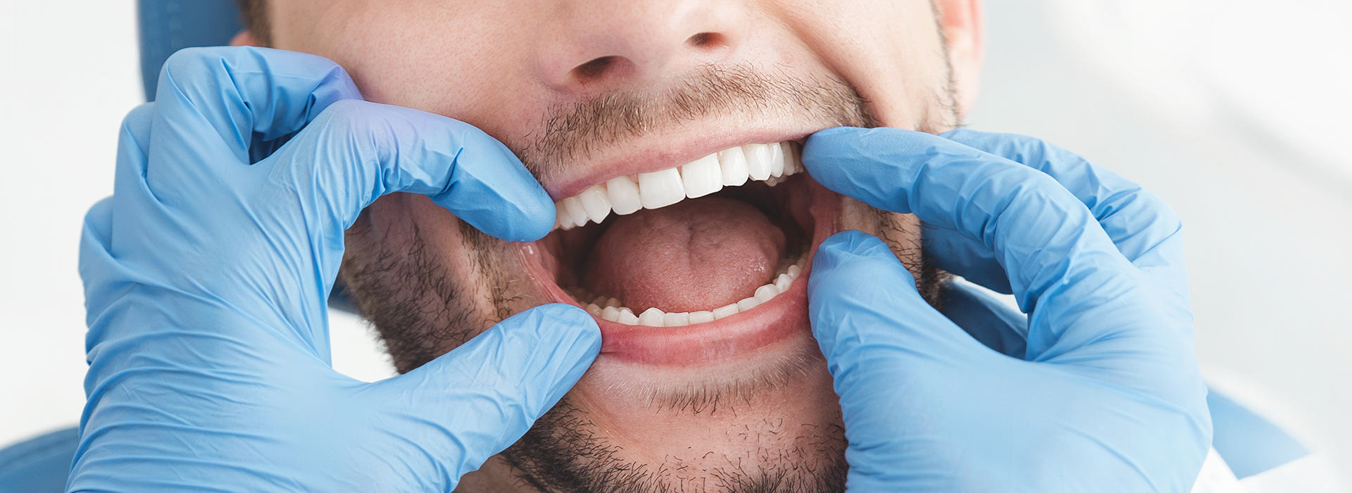 A man wearing a surgical mask and gloves, with his mouth open wide, is shown in a close-up.