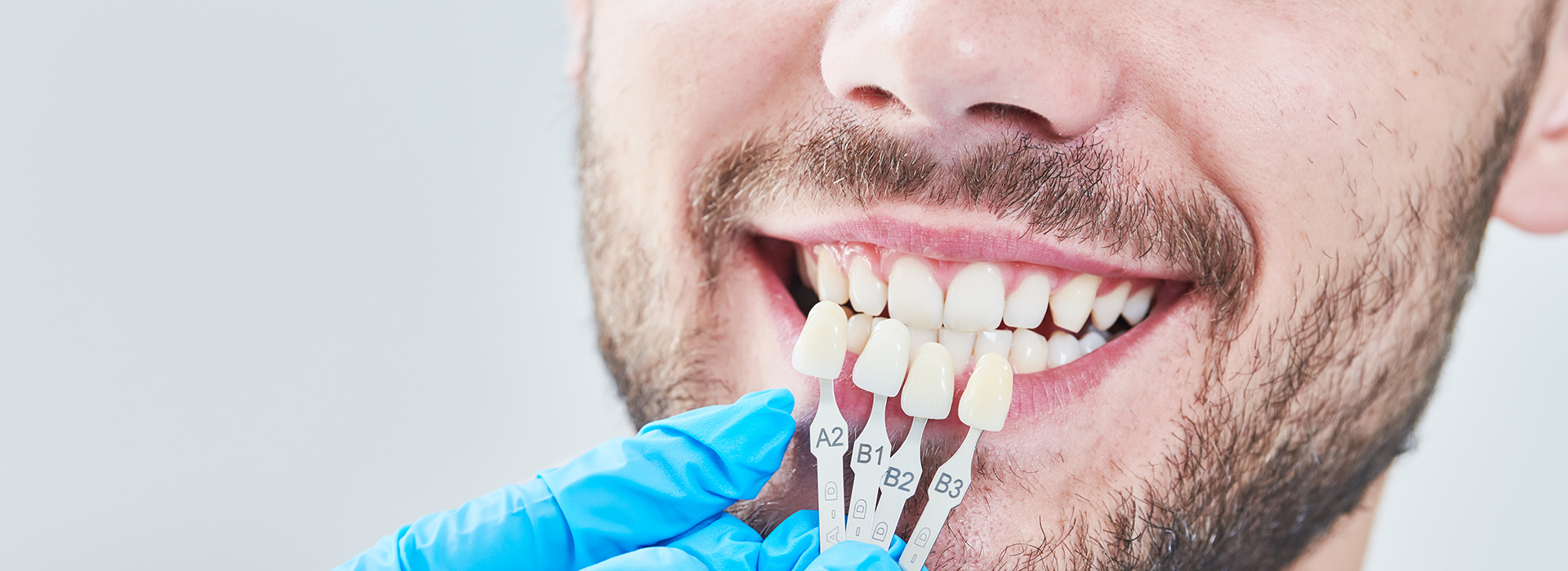 The image shows a person with a dental implant, smiling and looking directly at the camera.