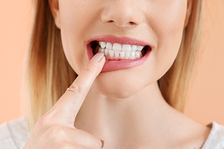 Stahl Dental Studio | Sedation Dentistry, Extractions and Full Mouth Reconstruction
