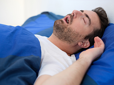 A man in a white shirt is lying in bed with his eyes closed, suggesting he is asleep or resting.